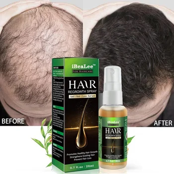 Джинджифил продукти за растеж на косата Бързо растящо етерично масло Биотин Предотвратяване на загуба Серумен спрей Лечение на скалпа Грижа за красотата за мъже Жени