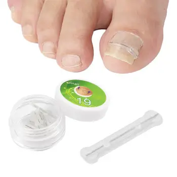10pcs врастнал инструмент за корекция на ноктите на краката врастнали нокти лечение еластичен пластир стикер изправяне клип скоба педикюр инструмент