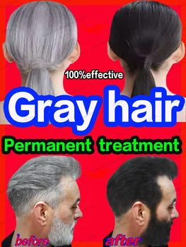 White Hair Treatment Serum Fast White To Black Repair Anti Gray Hair